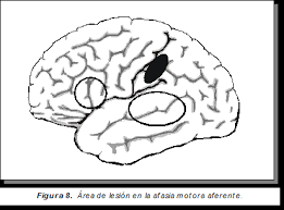 Maybe you would like to learn more about one of these? Conceptos Clinicos De Las Afasias Pagina 2 Monografias Com