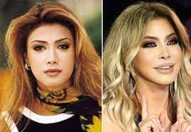 والله قبل كانت تجنن بس الحين الحمد لله والشكر. ØµÙˆØ± Ù†ÙˆØ§Ù„ Ø§Ù„Ø²ØºØ¨ÙŠ Ù‚Ø¨Ù„ ÙˆØ¨Ø¹Ø¯ Ø´Ø§Ù‡Ø¯ÙŠ Ù…Ø±Ø§Ø­Ù„ ØªØ·Ùˆ Ø± Ø¬Ù…Ø§Ù„Ù‡Ø§ Ø¹Ø¨Ø± Ø§Ù„Ø³Ù†ÙˆØ§Øª