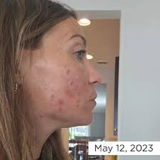 Today, at Convention 2023! Brittney McLaughlin, Melaleuca Customer since  2019. #TodayIWIll2023 #LivesChangeHere