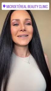 Siempre es buen momento de cuidarte 💛, Agenda tu cita en Calle General  ampudia, 6 @microetereal y te asesoramos en el mejor tratamiento para tu  tipo de piel, ...