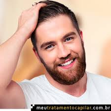 No meu ponto de vista, o implante capilar é a melhor forma de conseguir voltar a ter cabelos de um jeito seguro, sem perder tempo e sem enrolação. Preco De Transplante Ou Implante Capilar Em Curitiba Saiba Mais