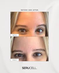 Want to reduce fine lines and wrinkles? 🧴 Hear from one of our experts,  Dr. Tom McClellan, Plastic Surgeon, as he breaks down when you can expect  to see results and what