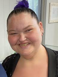 Amy's weight loss journey and oral hygiene concerns