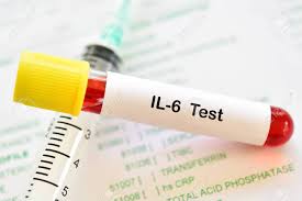This guide offers information about the ekg test and how ekg test results help health care providers accurately assess their patients. Blood Sample Tube For Interleukin 6 Or Il 6 Test Stock Photo Picture And Royalty Free Image Image 152672613