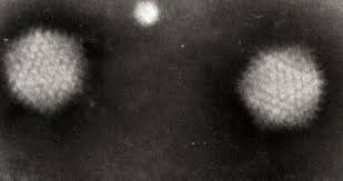 Learn about adenovirus symptoms, transmission, prevention adenovirus. Adenoviridae Wikipedia