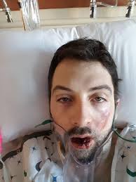 The fda couldn't review the safety of products that had been on the market before 2007. Vaper Shares Shocking Pictures After Suffering Second Degree Burns And Losing Seven Teeth When E Cigarette Exploded