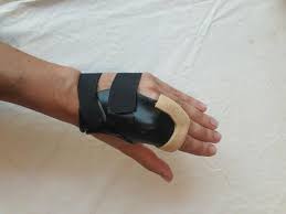 Image result for Radial Gutter Cast
