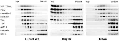 Hypothesized Mechanisms Of Aβ-Membrane Interaction. Carpet Effect, Ion... |  Download Scientific Diagram