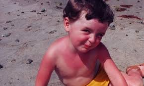Arsurile Solare La Copii