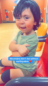 Campolemic Dysplasia