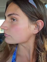 VENOMMMMM ♟️🖤💣