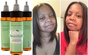 Maybe you would like to learn more about one of these? Amazon Com Beanstalk Hair Loss Treatment Promotes Fast Hair Growth In 2 Weeks Beauty Personal Care