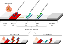 The lateral flow test has a lower sensitivity compared to pcr and means some positive cases will be missed with this test. Frontiers Development Of A Gold Nanoparticle Based Lateral Flow Immunoassay For Pneumocystis Pneumonia Serological Diagnosis At Point Of Care Microbiology