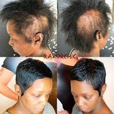Consider your haircut first many guys want to grow their hair long to make up for its lack of fullness. Alopecia Hair Styles Alopecia Hairstyles Short Sassy Hair Short Hair Styles Pixie