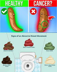 Image result for dark black stool human poop