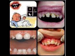 Pin En Odontologia