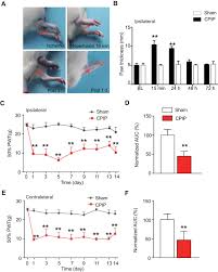 Electroacupuncture Alleviates Mechanical Allodynia In A Rat Model Of Complex Regional Pain Syndrome Type I Via Suppressing Spinal Cxcl12 Cxcr4 Signaling The Journal Of Pain