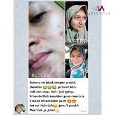 Kalau pakai helmet kena tahan tak. Info Meeracle Gemstone Skincare Testimoni Kosmetik Cida