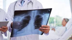Bisa dibilang ct scan adalah alat yang digunakan untuk membaca kondisi tubuh seseorang. Cara Baru Deteksi Virus Corona Dengan Ct Scan Paru Paru