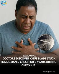 In one of the most puzzling medical anomalies, in recent times, a Tanzanian  man reportedly left doctors stunned following the discovery of a knife  that's believed to have been lodged in his