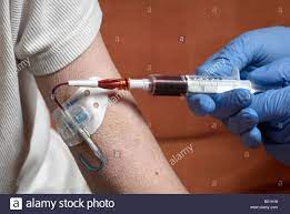 Drawing Blood From A Picc Line With Surgical Gloves (Peripherally Inserted  Central Catheter Stock Photo - Alamy