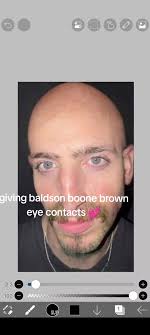 Bald Benson Boone