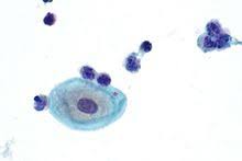 What is animal cell wikipedia. Navicular Cell Wikipedia Cell Science And Nature Floral Rings