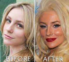 After competing in beauty pageants in their home state of washington and releasing original music. Courtney Stodden Plastic Surgery Before And After Photos Courtney Stodden Plastic Surgery Photos Plastic Surgery
