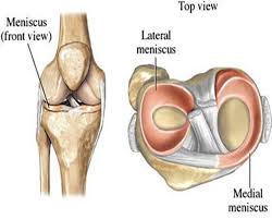 That's not limited to yoga, it's a common problem in the general more specifically, meniscus injuries are also high on the list, particularly for a practitioner who puts their legs and knees more specifically into more. Meniscal Tears Brisbane Knee And Shoulder Clinic Dr Macgroartybrisbane Knee And Shoulder Clinic