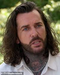 Pete Wicks addresses why his face looked 'so different'