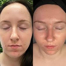 Beautiful Skin by Molly (@beautifulskinbymolly) • Instagram photos and  videos