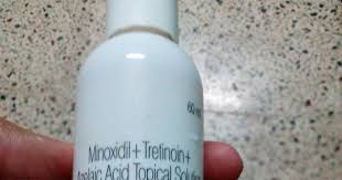 Detailed information related to minokem n 5 lotion's uses, composition, dosage, side effects and reviews is listed below. Product Reviews Minokem N 5 Reviews And Side Effects