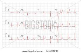 Heart Cardiogram Vector Photo Free Trial Bigstock