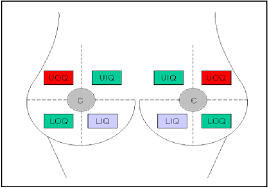 This article describes the anatomy of the female breast and mammary glands, including the blood supply and innervation. An Illustration Of How The Breast Is Divided Into Quadrants E G Uoq Download Scientific Diagram