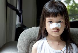 Nosebleeds In Kids Types Reasons Treatment