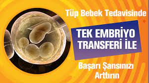 tup bebek basari sansi prof dr gamze sinem caglar