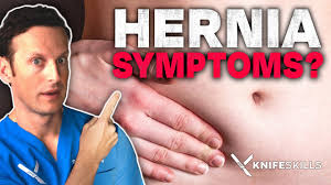 Image result for stomach hernia symptoms
