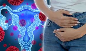 Featuring content from mayo clinic. Ovarian Cancer Feeling Constantly Bloated Could Be An Early Sign Of The Disease Sound Health And Lasting Wealth