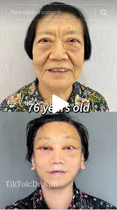 His shocking before and after photos are going viral