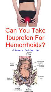 Pin On Do Hemorrhoids Go Away On Their Own