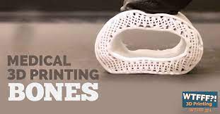 Where Medical 3d Printing Is Headed 3d Printing Bones 3d Printing Prints Medical