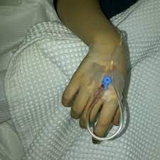 كشك ذوبان الجليد ذوبان الجليد ذوبان الجليد مركب يد فيها مغذي في المستشفى رجال comertinsaat com