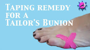 Check spelling or type a new query. Taping Remedy For A Tailor S Bunion Bunionette Youtube