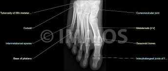 I m having foot pain and had an xray today and the findings are as follows: Radiological Anatomy Of The Lower Limb