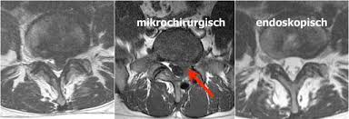 Der patient liegt bei der op auf dem bauch. Prof Dr Christian Woiciechowsky Neurochirurgie Berlin Haufig Gestellte Fragen Faq
