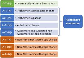 New Biological Research Framework For Alzheimers Seeks To