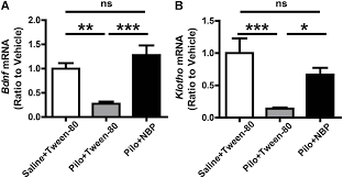 Usually though it only weighs 1.5gm Frontiers Protective Role Of L 3 N Butylphthalide In Cognitive Function And Dysthymic Disorders In Mouse With Chronic Epilepsy Pharmacology
