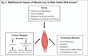 Sarcopenia is a common cause of muscle weakness in the elderly. What Is The Relationship Between Sarcopenia And Cancer