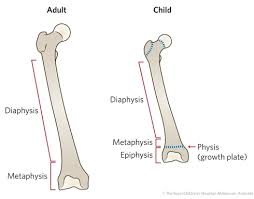 Primary features of a long bone. Fracture Education Anatomic Differences Child Vs Adult