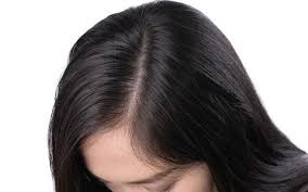 Jun 5, 2017 at 12:09 pm. Scalp Buildup The Truth You Need To Know Skinkraft